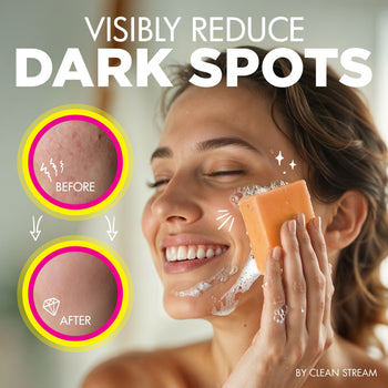 Glow Kojic Acid Brightening Dark Spot Remover Soap